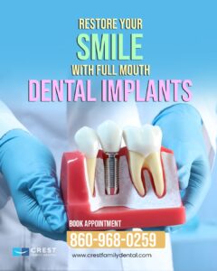Cost of Dental Implants