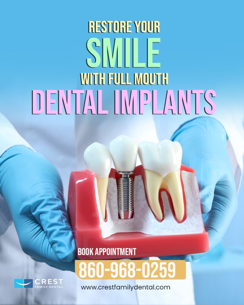 Cost of Dental Implants